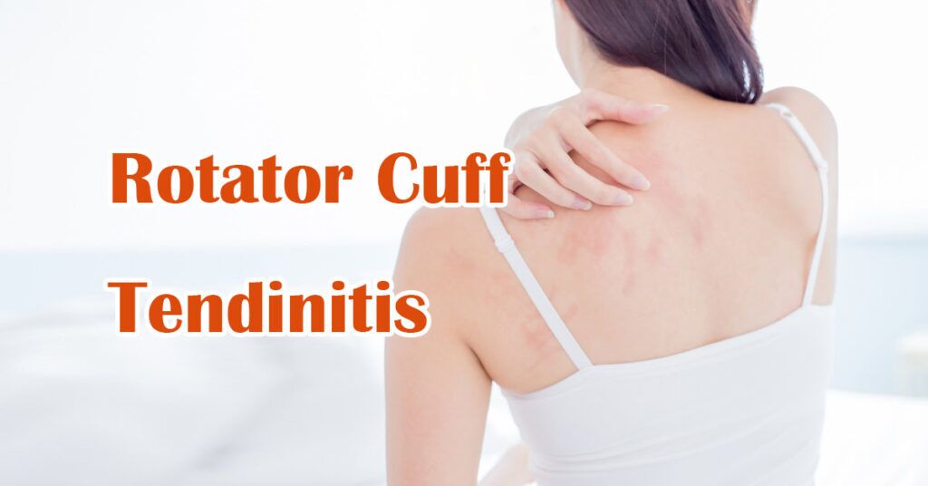 Rotator Cuff Tendinitis – Light and Wisdom – Meditation, Healing ...